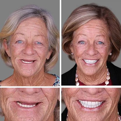⚡ 🌎Ends Today: 70% OFF! ⏰ Medical Full Denture with Strong Suctiond